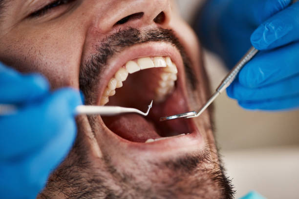 Why Choose Us for Your Dental Needs in Red Corral, CA